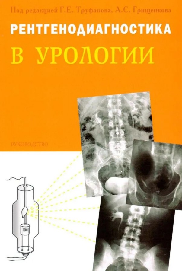 Ренгенодиагностика в урологии